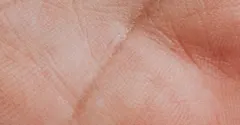Do identical twins have the same fingerprints? No, and here's why