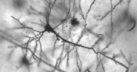What Causes Déjà Vu? The Science Behind That Eerie Feeling