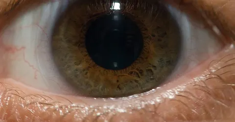 Why Do People Have Different Eye Colors? The Pigment Trick Behind Your Iris