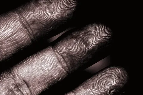Why do we have fingerprints? A mystery science hasn't solved
